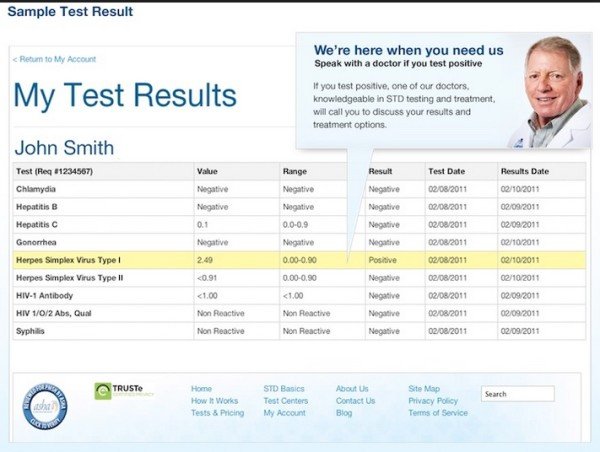 Std Results form Pdf How to Get Std Tested In New York City W O Visiting A Doctor